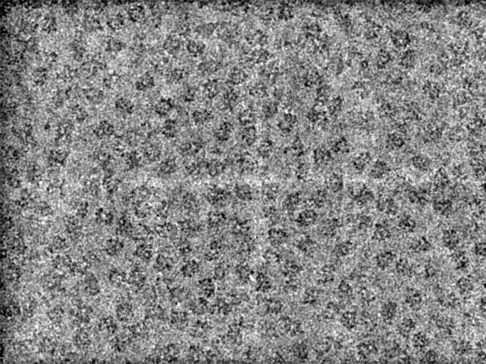 Raw cryo-electron microscopy micrograph showing individual protein particles suspended in vitreous ice.